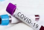 COVID-19: NCDC reports 423 new infections, no death