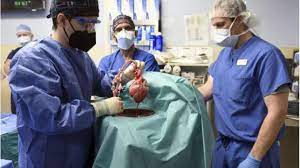 U.S. surgeons transplant pig’s heart into adult human for first time