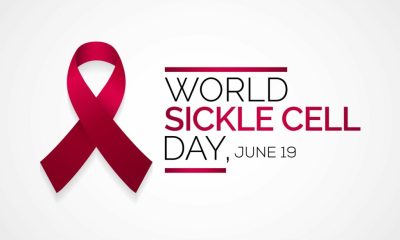 World Sickle Cell Day: NOA reiterates commitment to raising awareness
